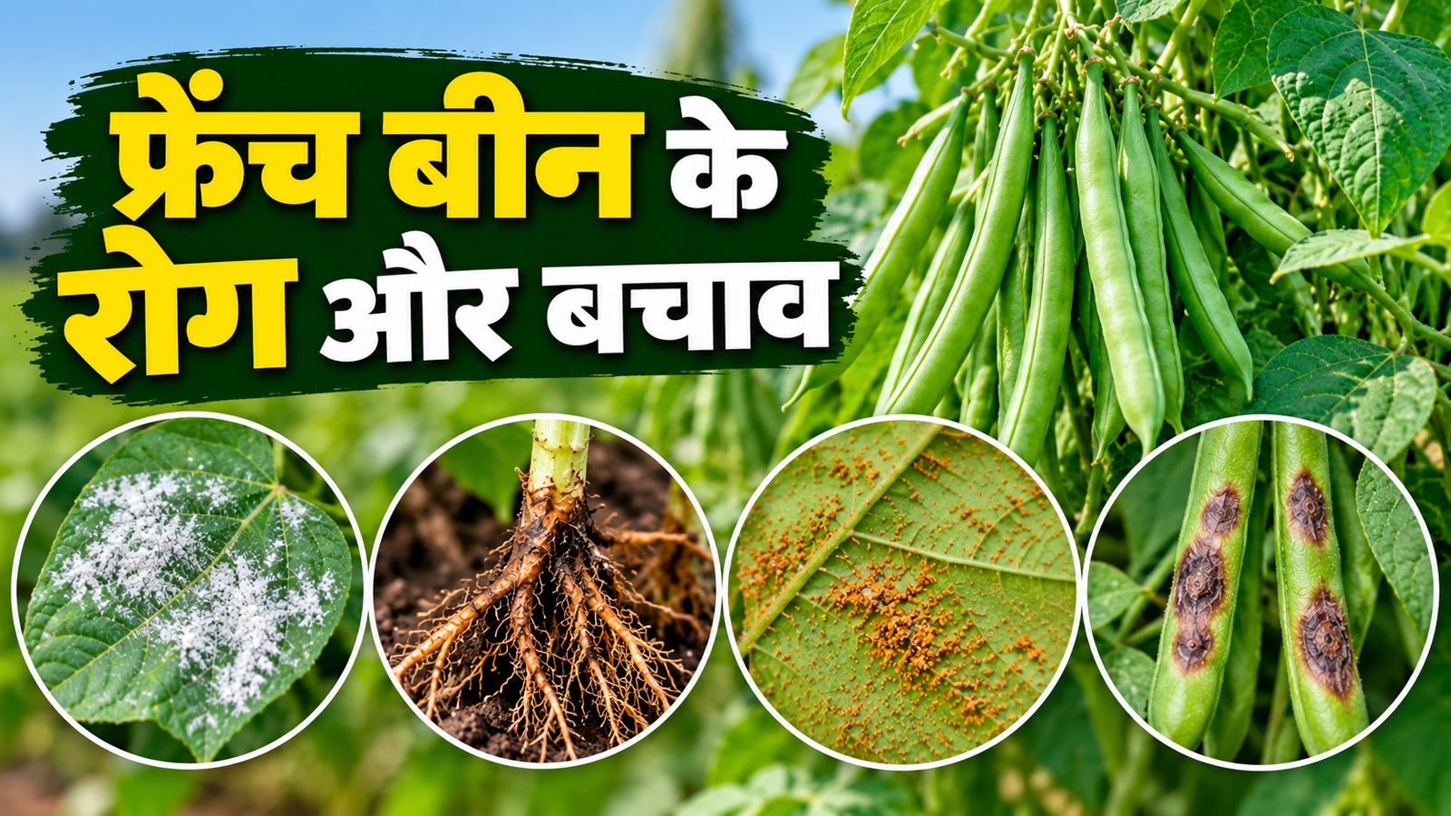फ्रेंच बीन की फसल में लगने वाले 4 प्रमुख रोग, पत्तियों पर दिखें ऐसे लक्षण तो तुरंत करें बचाव French Bean Ke Rog Aur Upay